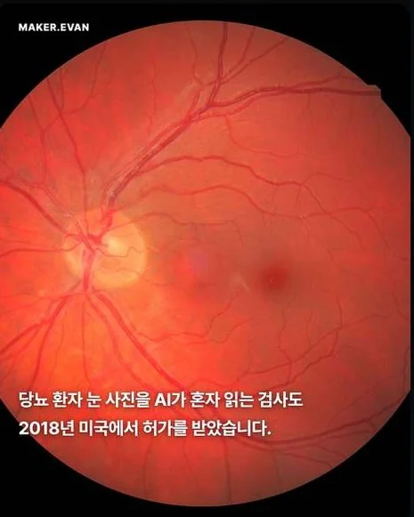 판매자 공개 카드뉴스: 망막 사진과 한글 카피